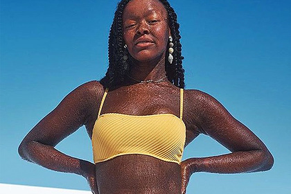 Девушка с чешуйчатой кожей снялась в рекламе купальника