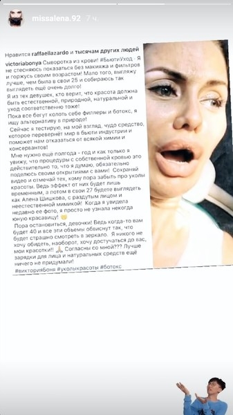 Алена Шишкова назвала Викторию Боню психически нездоровой