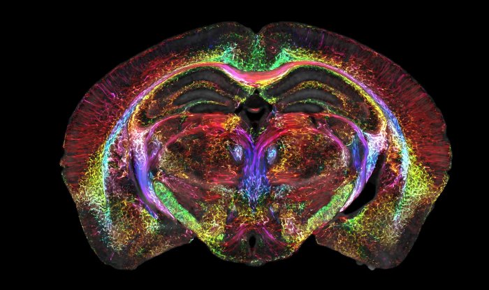 Ученые научились делать фантастически четкую МРТ мозга 