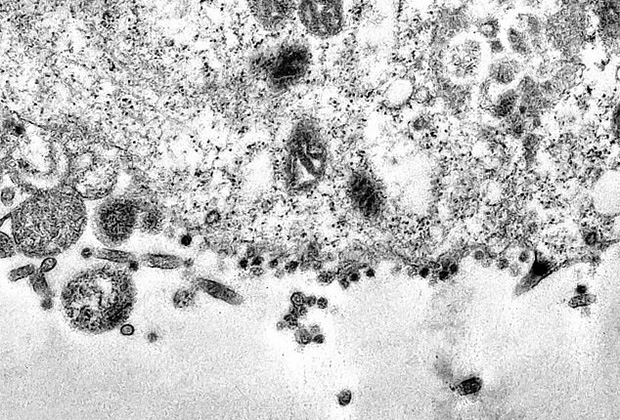 Момент заражения коронавирусом показали под микроскопом