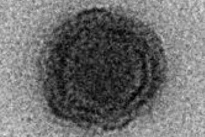 Обнаружен загадочный вирус-отшельник с неизвестной ДНК